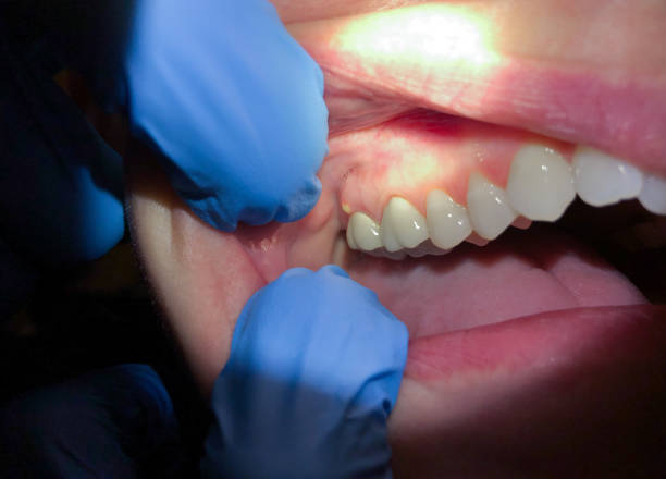  Johnson Lane, NV Emergency Dentist Pros