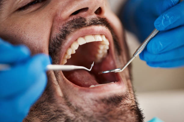 Best Emergency Broken Tooth Repair in Johnson Lane, NV